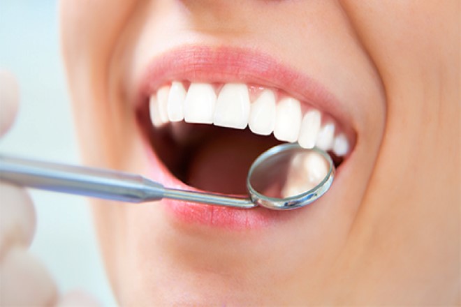 Diş Dolgusu Nasıl Yapılır? 2